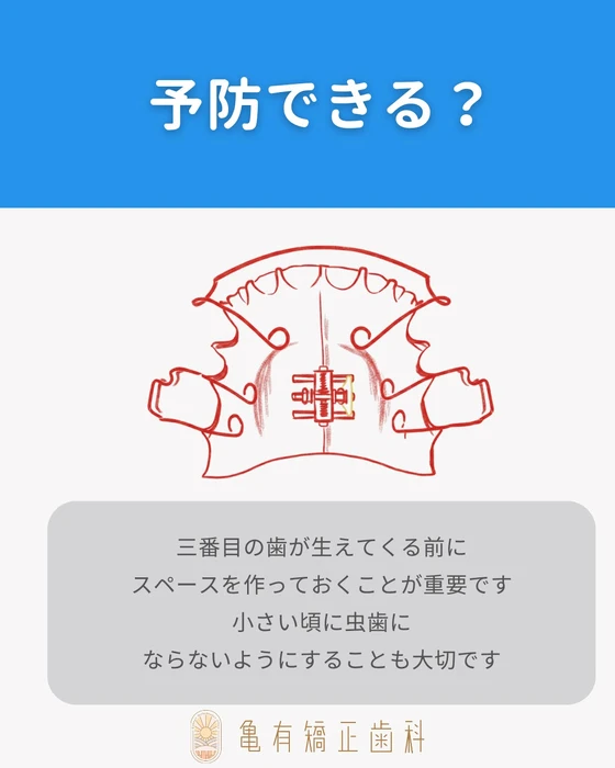 画像292