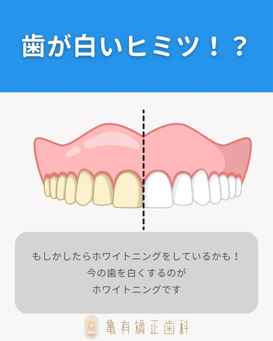 画像311