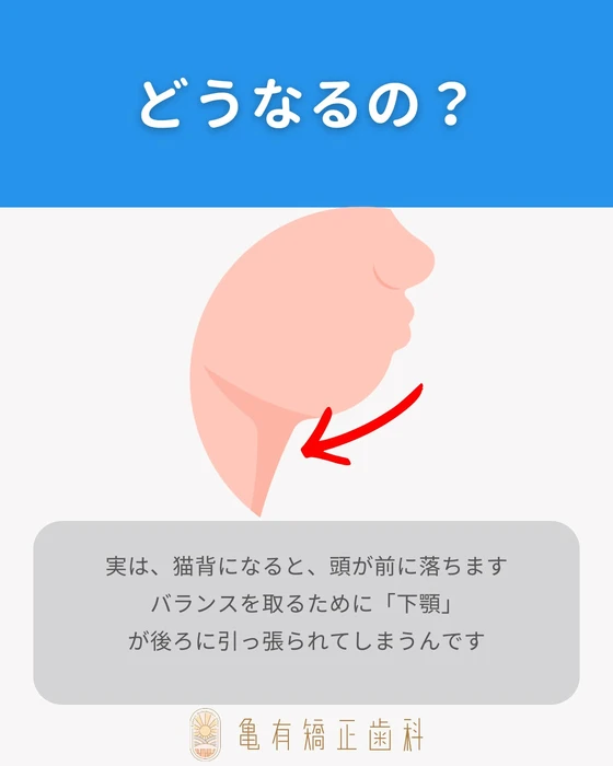 画像323