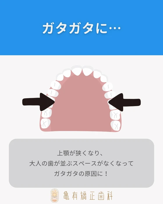 画像326