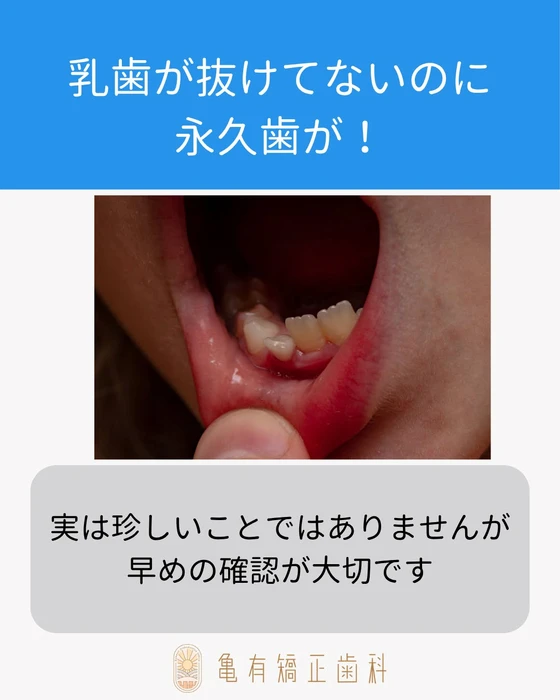 画像523
