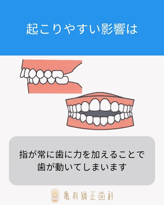 画像537