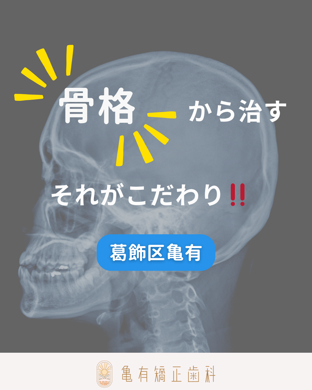 成長期のお子さまのための歯並び改善を亀有で実現！