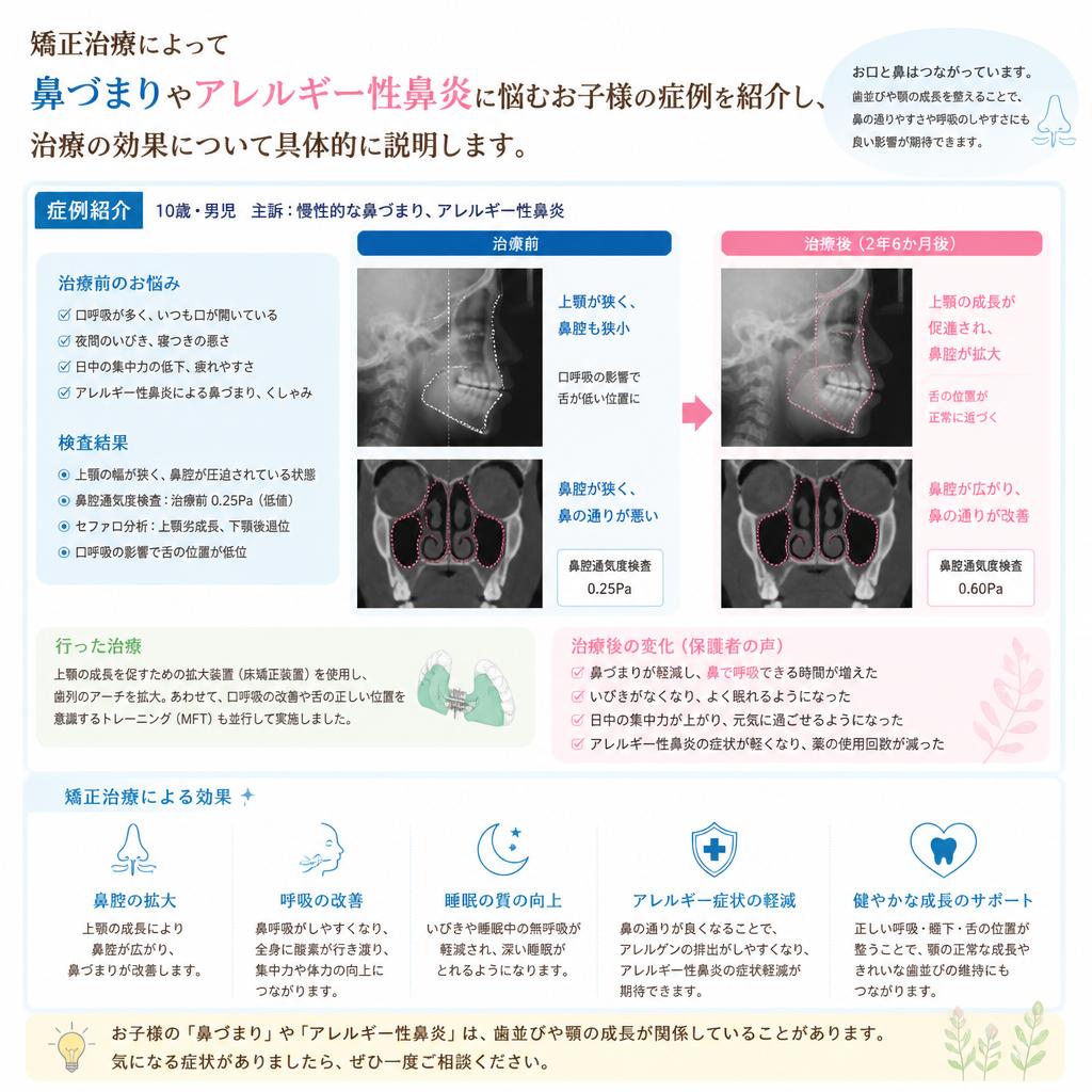 症例紹介：実際の矯正治療の効果